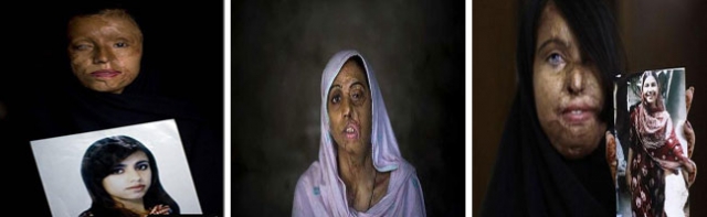 المتطرفون يستقبلون النساء بإلقاء الحمض عليهن في شوارع باكستان
