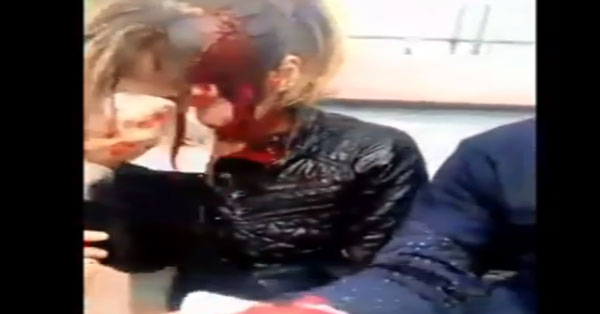 مصدر أمني... يكشف حقيقة صورة التلميذة المصابة بجروح (مع فيديو)