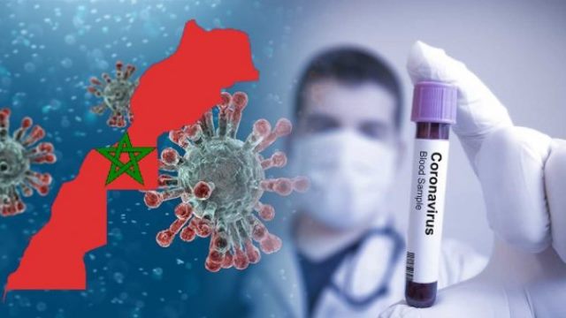 وزارة الصحة تسجل 73 حالة إصابة مؤكدة جديدة بفيروس كورونا