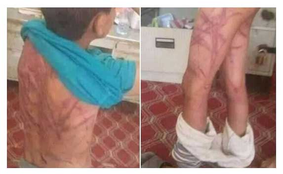 طفل يمني يتحول بقدرة "الأخبار المزيفة" إلى موضوع مغربي يتعلق بإحراقه!