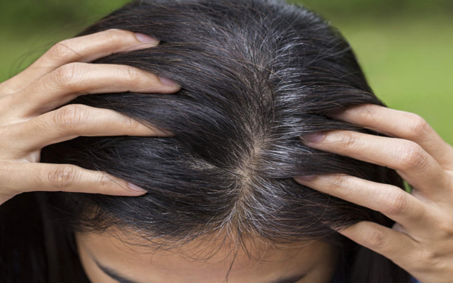 5 نصائح مهمة تحمي شعرك من التساقط والشيب المبكر